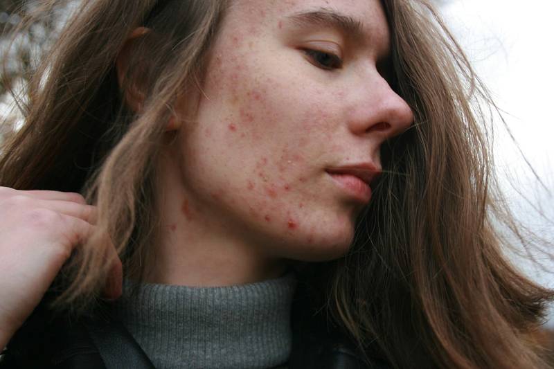 Photo by Barbara Krysztofiak