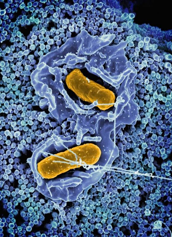 Photo by National Institute of Allergy and Infectious Diseases