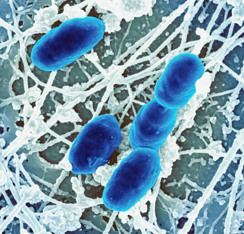 Photo by National Institute of Allergy and Infectious Diseases