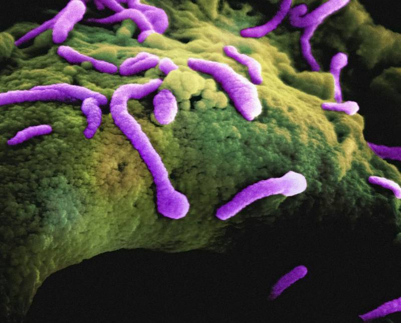 Photo by National Institute of Allergy and Infectious Diseases