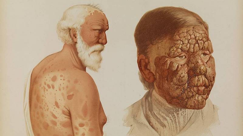 starší mužský pacient, hlava, ramena a trup zprava