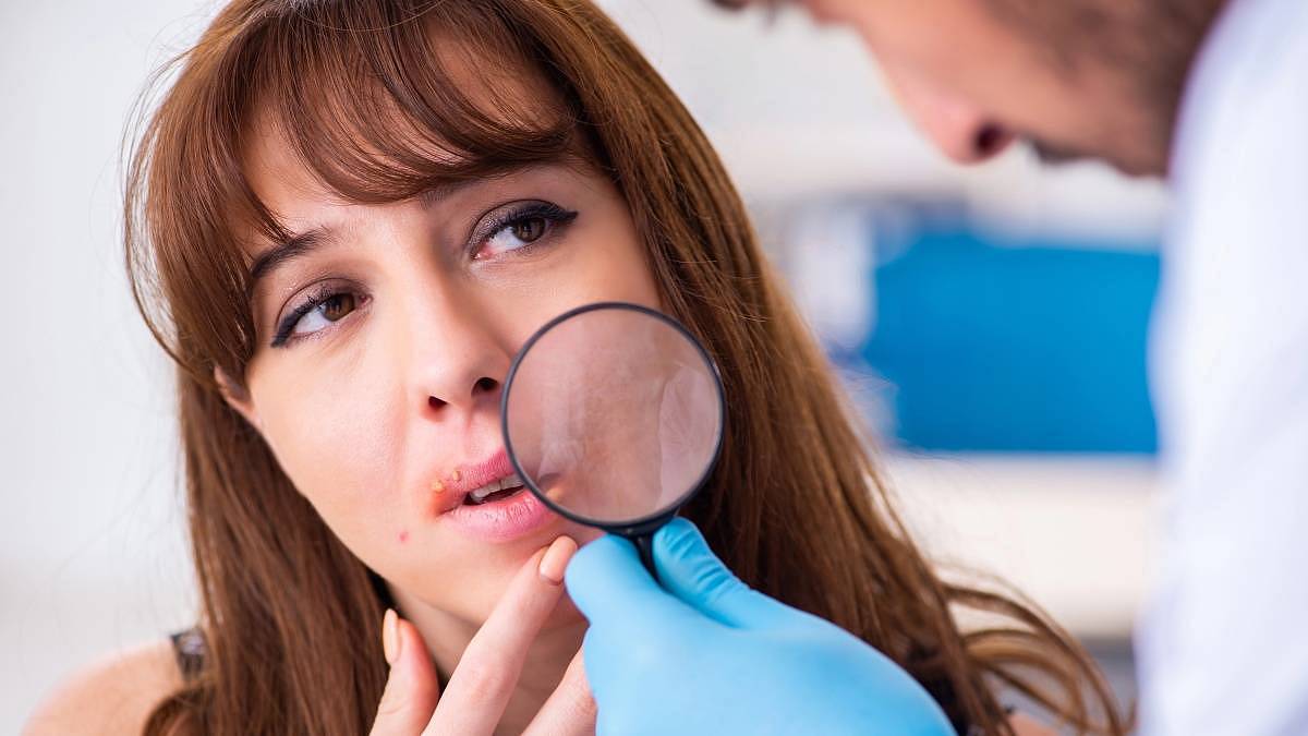 Med jako přírodní řešení: Účinná pomoc v boji proti oparům
