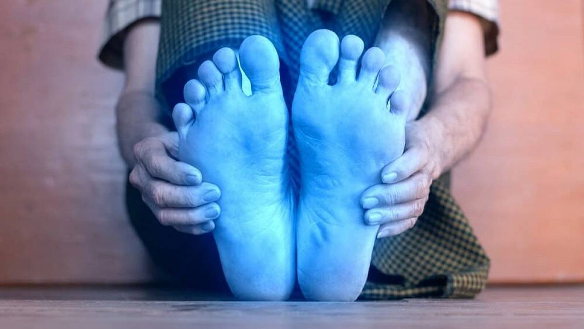 Jak laik pozná vysoký cholesterol? Pokud toto dělají vaše nohy, jděte k lékaři