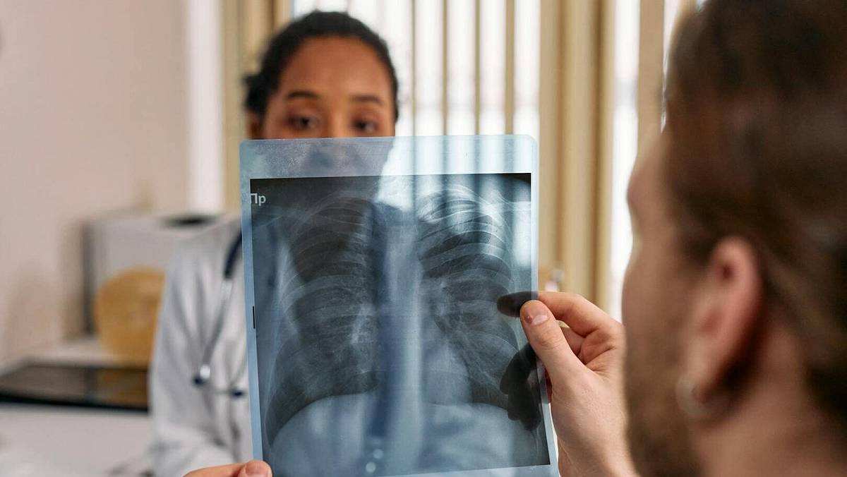 Výskyt tuberkulózy je v Česku nízký: klíčová je prevence a včasné odhalení