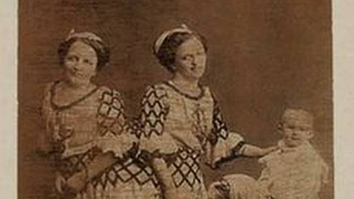 Jediná česká siamská dvojčata, která dokázala uhranout svět. Rosa a Josefina Blažkovy